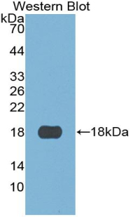 Monoclonal Antibody to S100 Calcium Binding Protein A3 (S100A3)