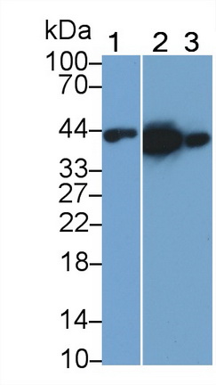 Monoclonal Antibody to Creatine Kinase B (CK-BB)