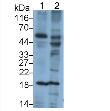 Monoclonal Antibody to Interleukin 24 (IL24)