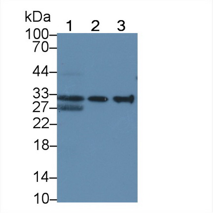 Monoclonal Antibody to HLA Class II Histocompatibility Antigen, DRB1 Beta Chain (HLA-DRB1)