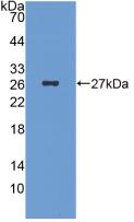Monoclonal Antibody to Islet Cell Autoantigen 1 (ICA1)