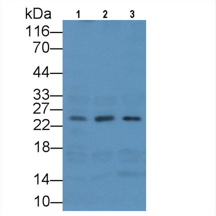Monoclonal Antibody to Methionine Sulfoxide Reductase A (MSRA)