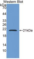 Monoclonal Antibody to Adenylyl Cyclase Associated Protein 2 (CAP2)