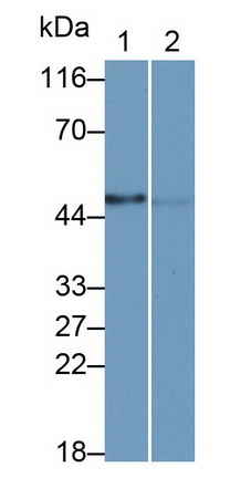 Monoclonal Antibody to Carcinoembryonic Antigen Related Cell Adhesion Molecule 8 (CEACAM8)