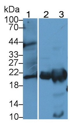 Monoclonal Antibody to Ferritin, Light Polypeptide (FTL)