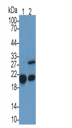 Monoclonal Antibody to Ferritin, Heavy Polypeptide (FTH)
