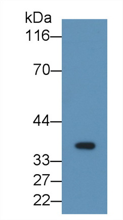 Monoclonal Antibody to Fibrinogen Like Protein 1 (FGL1)