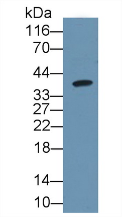 Monoclonal Antibody to Carbonic Anhydrase IV (CA4)