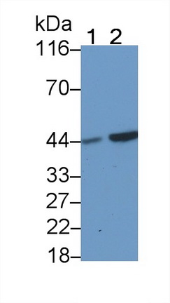 Monoclonal Antibody to Casein Kinase 1 Delta (CSNK1d)