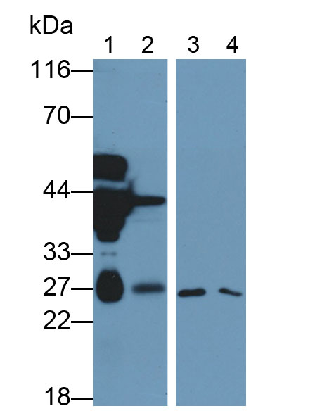 Monoclonal Antibody to Deoxythymidylate Kinase (DTYMK)