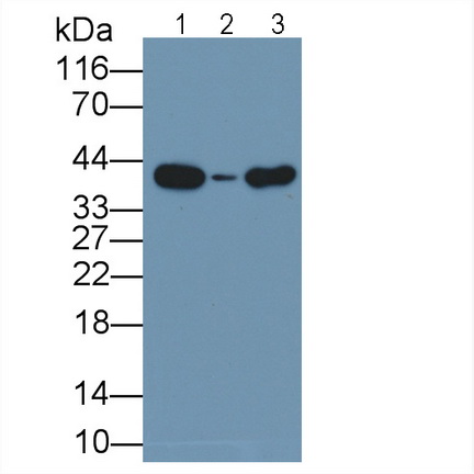 Monoclonal Antibody to Arginase II (Arg2)
