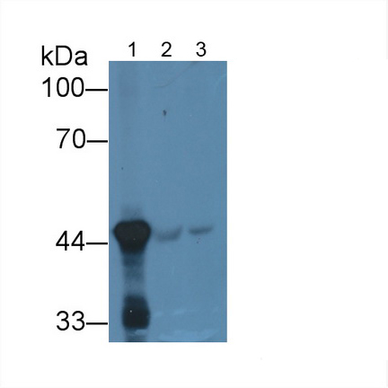 Monoclonal Antibody to 4-Hydroxyphenylpyruvate Dioxygenase (HPD)