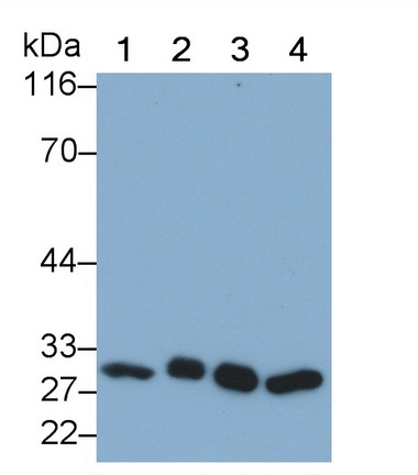 Monoclonal Antibody to Phosphoglycerate Mutase 1, Brain (PGAM1)
