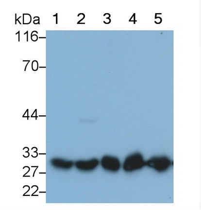 Monoclonal Antibody to Phosphoglycerate Mutase 1, Brain (PGAM1)
