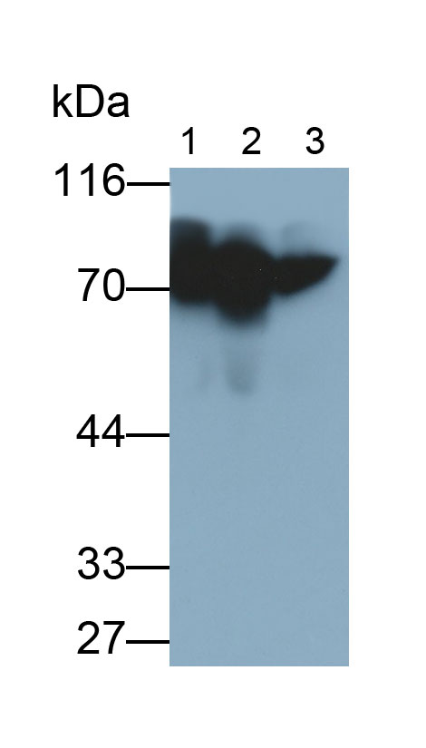 Monoclonal Antibody to Alpha-1-B-Glycoprotein (a1BG)