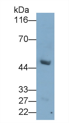 Monoclonal Antibody to Anthrax Toxin Receptor 2 (ANTXR2)