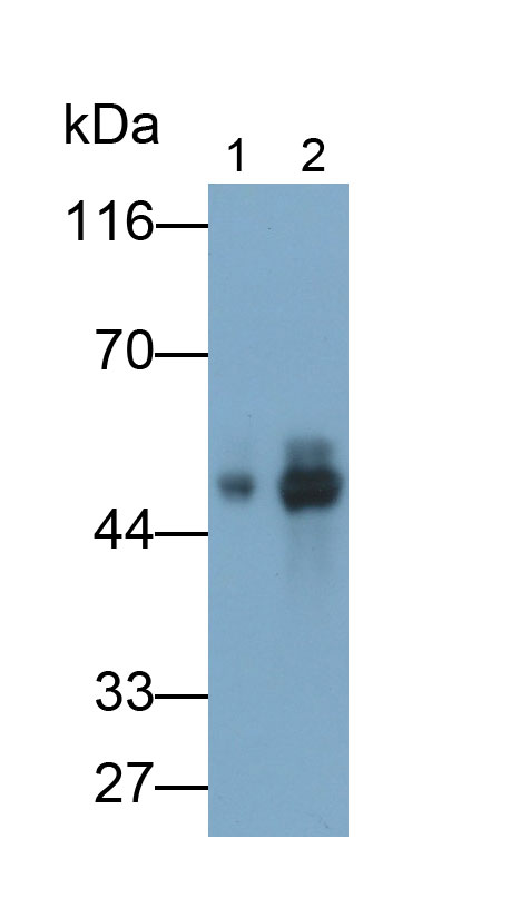 Monoclonal Antibody to Uroplakin 3A (UPK3A)