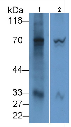 Monoclonal Antibody to 2',5'-Oligoadenylate Synthetase 2 (OAS2)