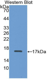Monoclonal Antibody to A Disintegrin And Metalloproteinase With Thrombospondin 2 (ADAMTS2)