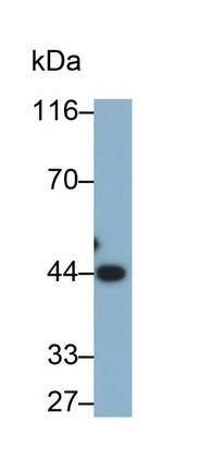 Monoclonal Antibody to Alpha-2-Glycoprotein 1, Zinc Binding (aZGP1)