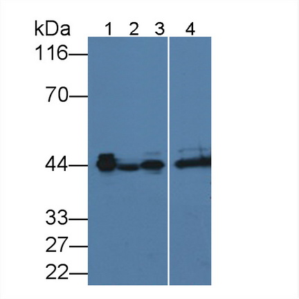Monoclonal Antibody to Alpha-2-Glycoprotein 1, Zinc Binding (aZGP1)