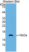 Monoclonal Antibody to CASP2 And RIPK1 Domain Containing Adaptor With Death Domain Protein (CRADD)