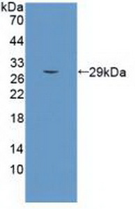 Monoclonal Antibody to Semaphorin 5B (SEMA5B)