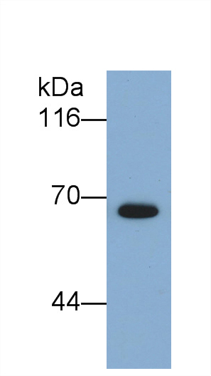 Monoclonal Antibody to Semaphorin 5B (SEMA5B)