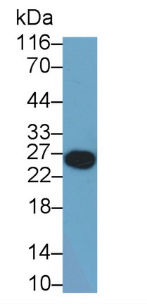 Monoclonal Antibody to T-Cell Immunoreceptor With Ig And ITIM Domains Protein (TIGIT)