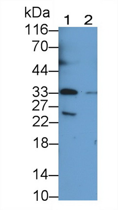 Monoclonal Antibody to T-Cell Immunoreceptor With Ig And ITIM Domains Protein (TIGIT)