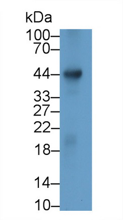 Monoclonal Antibody to Rh Blood Group, D Antigen (RHD)
