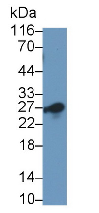 Monoclonal Antibody to Cluster Of Differentiation 8b (CD8b)