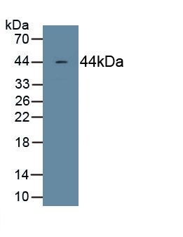 Monoclonal Antibody to Complement Component 4c (C4c)