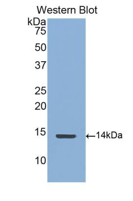 FITC-Linked Polyclonal Antibody to Connective Tissue Growth Factor (CTGF)