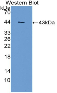 Polyclonal Antibody to Chemokine C-C-Motif Ligand 3 Like Protein 1 (CCL3L1)
