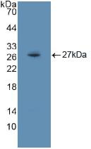 Polyclonal Antibody to FMS Like Tyrosine Kinase 3 (Flt3)