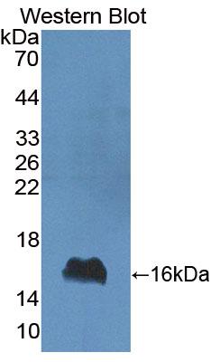 Polyclonal Antibody to Interferon Gamma (IFNg)