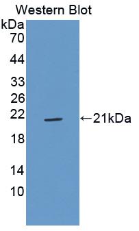 Polyclonal Antibody to Insulin Like Growth Factor 2 (IGF2)