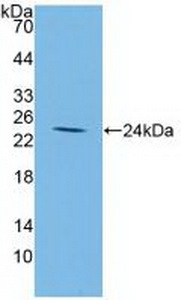 Polyclonal Antibody to Insulin Like Growth Factor Binding Protein 2 (IGFBP2)