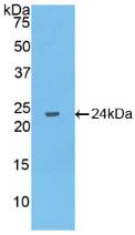 Polyclonal Antibody to Interleukin 10 (IL10)