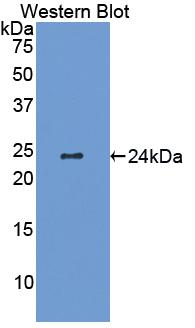 Biotin-Linked Polyclonal Antibody to Interleukin 6 (IL6)