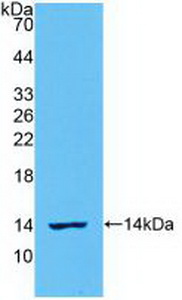 Polyclonal Antibody to Interleukin 8 (IL8)