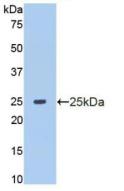 Polyclonal Antibody to Matrix Metalloproteinase 13 (MMP13)