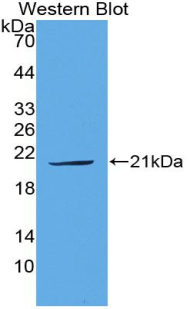 Polyclonal Antibody to Plasminogen Activator, Urokinase (uPA)