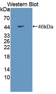 Polyclonal Antibody to Adiponectin Receptor 1 (ADIPOR1)