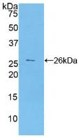 Polyclonal Antibody to Carbohydrate Antigen 125 (C<b>A125</b>)