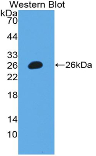 Biotin-Linked Polyclonal Antibody to Carbohydrate Antigen 125 (C<b>A125</b>)