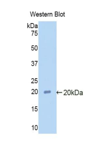 Polyclonal Antibody to Alpha 2-Antiplasmin (a2PI)