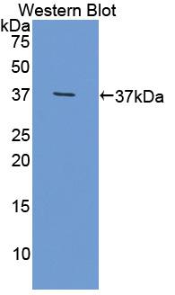 Polyclonal Antibody to Olfactomedin 4 (OLFM4)
