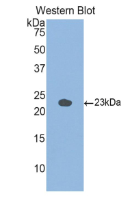 Polyclonal Antibody to Glucosidase Alpha, Acid (GaA)